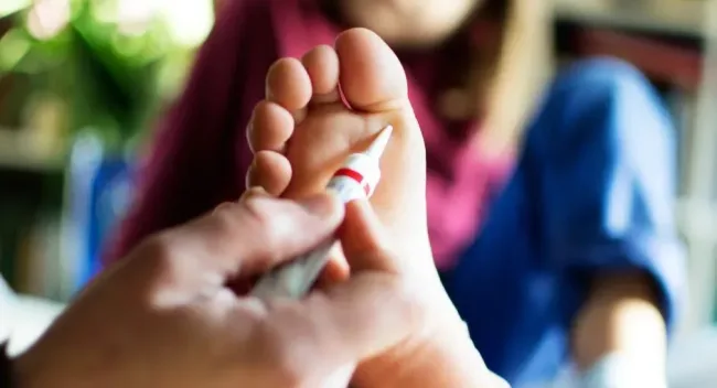 Verruca Treatment Information about verrucas 1